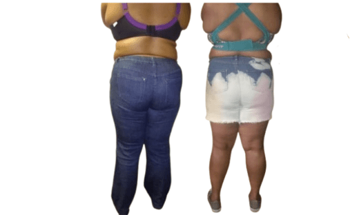 Smart Lipo 360