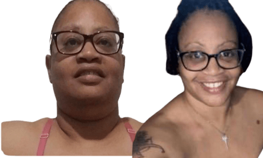 Facial Sculpting