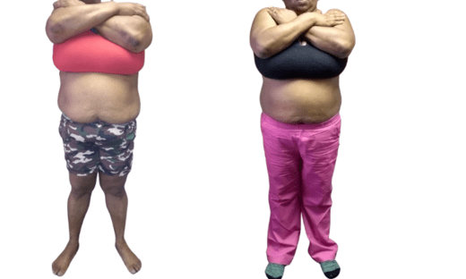 Mommy Makeover
