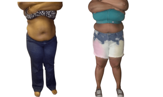 Smart Lipo 360