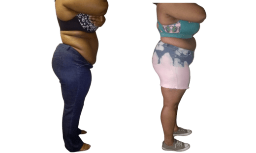 Smart Lipo 360